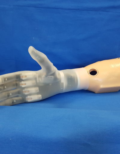 Myoelektrische Armprothese mit Silikon-HTV Schaft