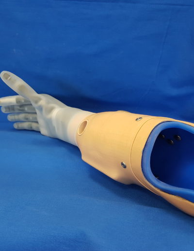 Myoelektrische Armprothese mit Silikon-HTV Schaft