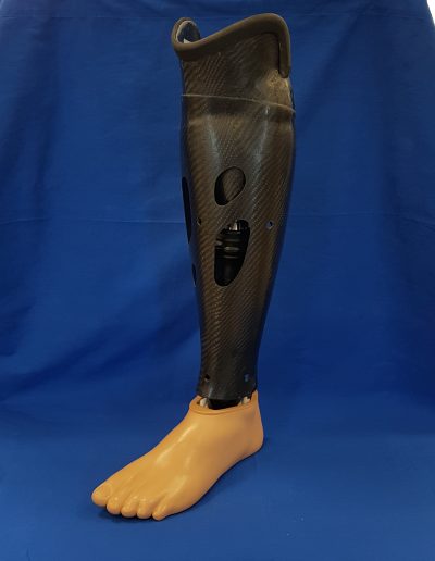 Unterschenkelprothese mit aktivem Vacuum-System mit Carbonverkleidung