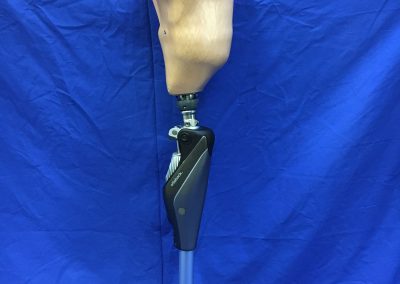 Genium Beinprothese mit HTV Silikon Innenschaft