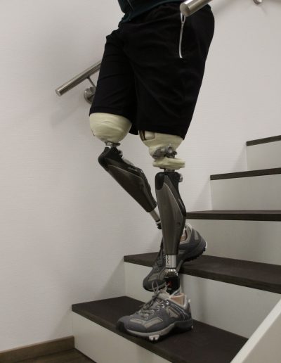 Oberschenkelprothese bilateral beim Treppen gehen